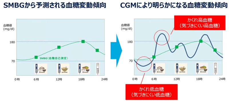 SMBGが予測される血糖変動傾向　GGMにより明らかになる血糖変動傾向
